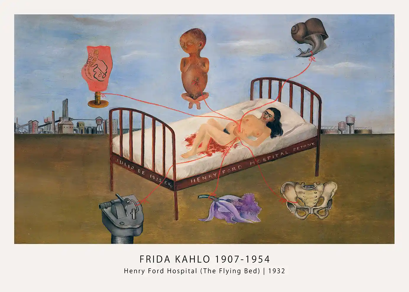 Henry Ford Hospital (1932) Frida Kahlo Poster — Wall Art Print