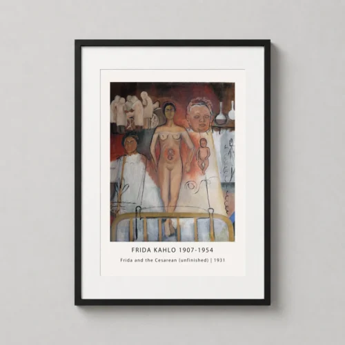 Frida and the Cesarean 1931 Unfinished Kahlo Painting Art Print