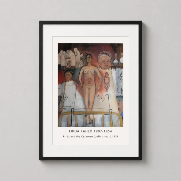 Frida and the Cesarean 1931 Unfinished Kahlo Painting Art Print